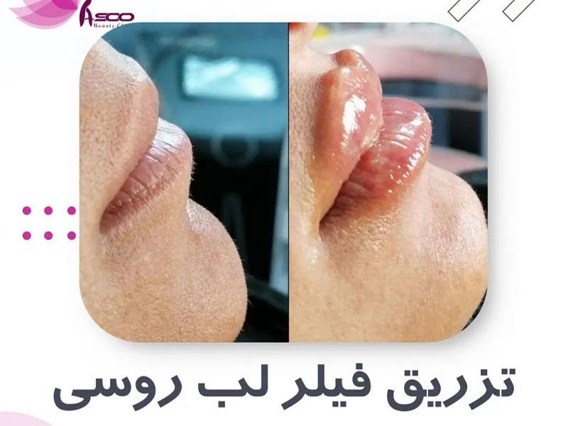 آسو در تهران؛ تصویر 3 از فضای مجموعه و نمونه‌کارها