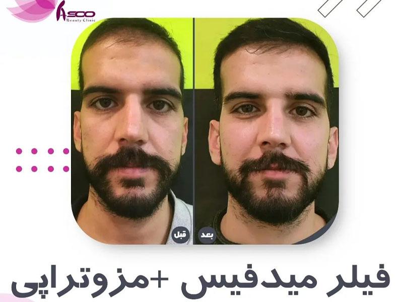 آسو در تهران؛ تصویر 2 از فضای مجموعه و نمونه‌کارها