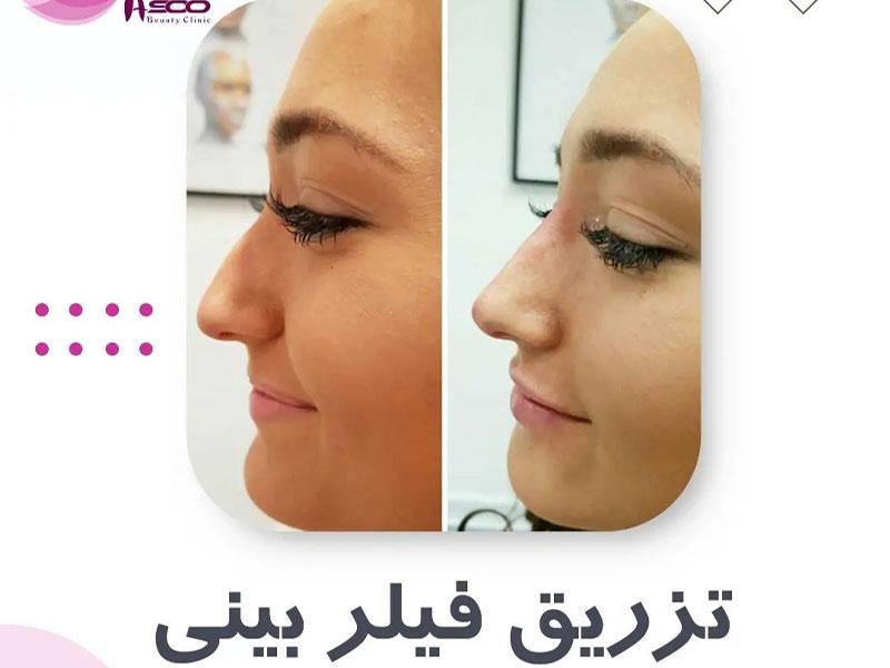 فضای مرکز لیزر آسو