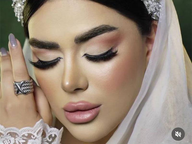 ملورین در سبزوار؛ تصویر 2 از فضای مجموعه و نمونه‌کارها