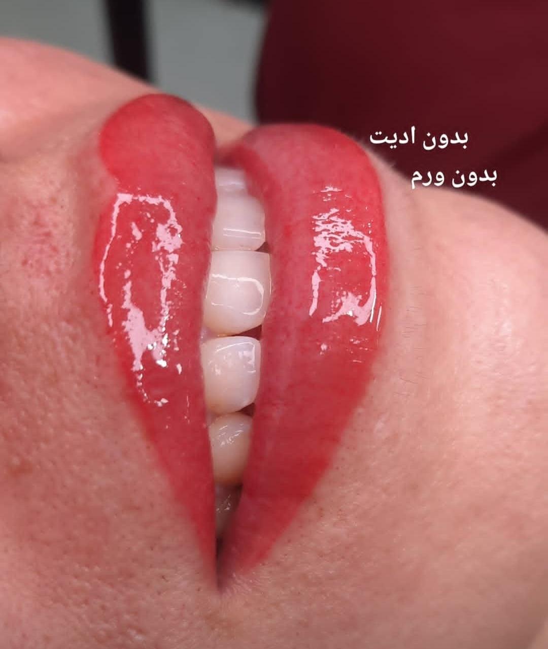 تصویر 3 آگهی میکرو کار حرفه ای با سابقه
