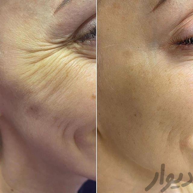 تصویر 3 آگهی آموزش و استخدام دوره های زیبایی