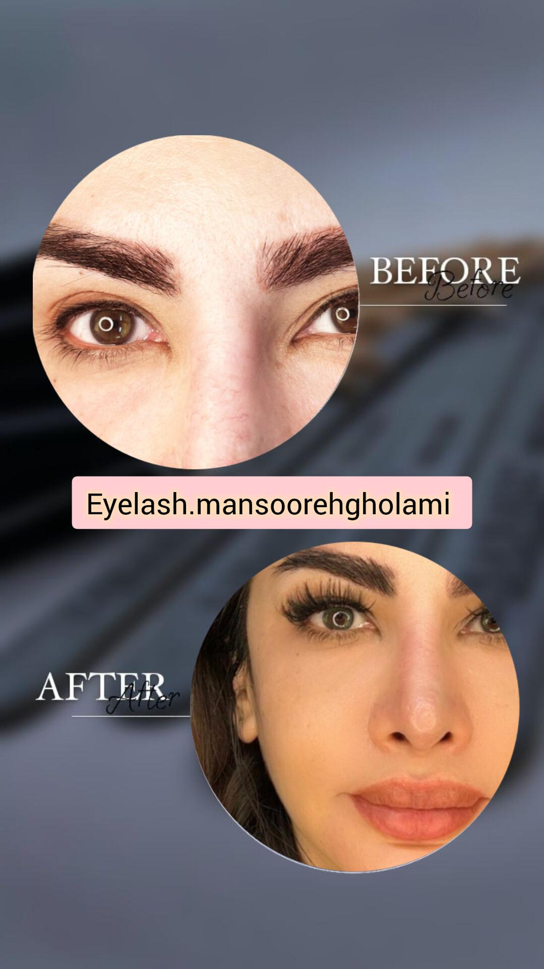 تصویر آگهی کاشت موقت مژه