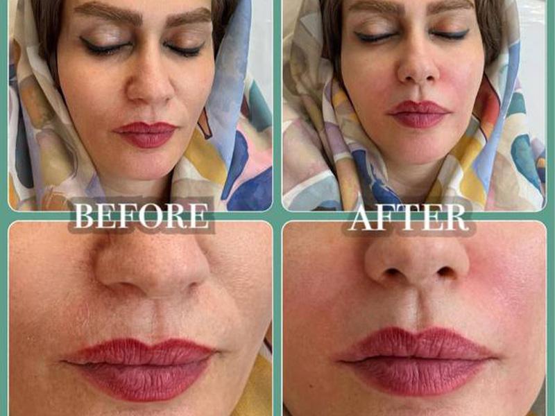فضای مرکز لیزر کلینیک زیبایی مانلی