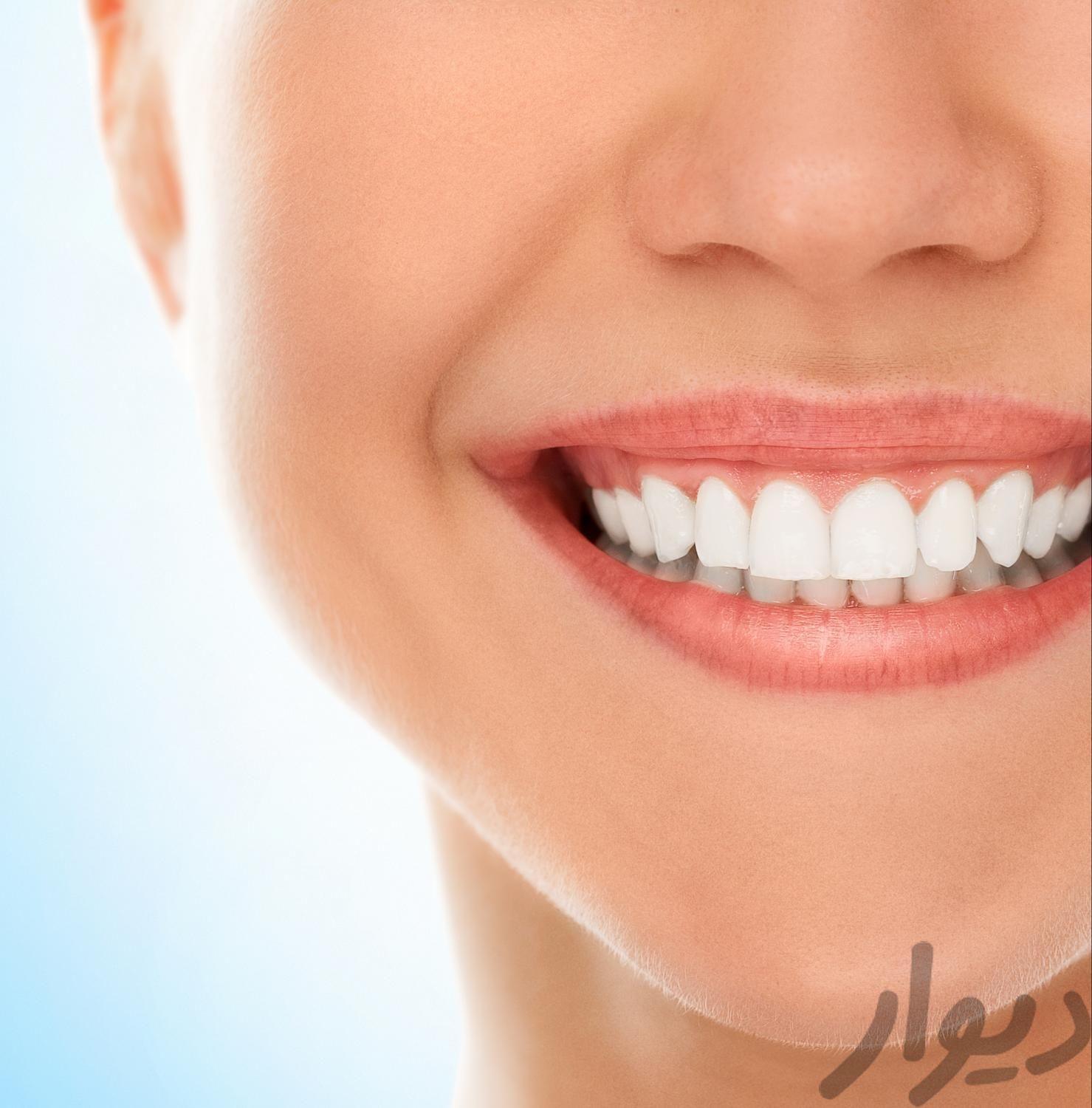 منشی دندانپزشک حرفه ای خانم (پاسداران)