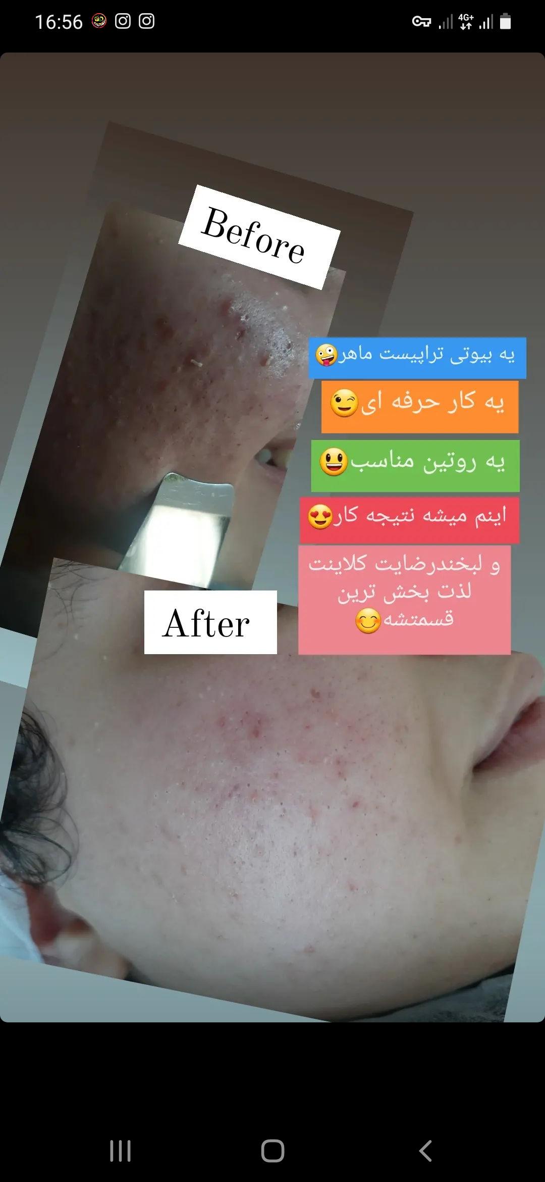 فیشیالیست حرفه ای