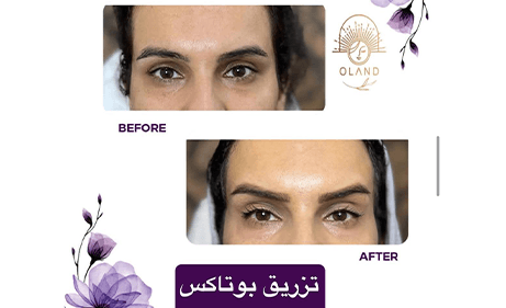 کلینیک زیبایی اولند